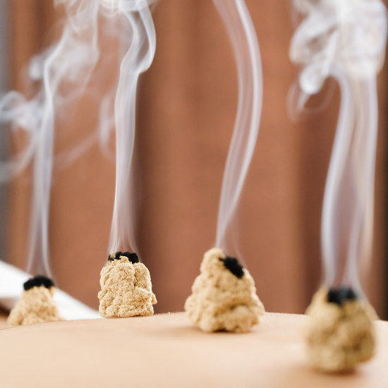Moxibustion